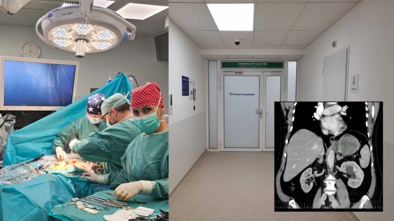 Snímka z operačnej sály počas laparoskopického zákroku a CT vyšetrenie nádoru